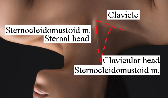 neck_CVC.PNG