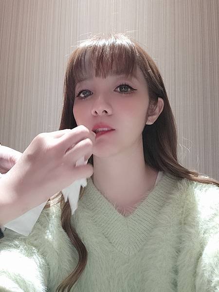 打造動人的美唇-玻尿酸嘟嘟唇~
