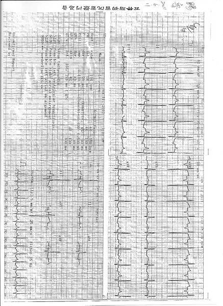 tiruECG 001.jpg