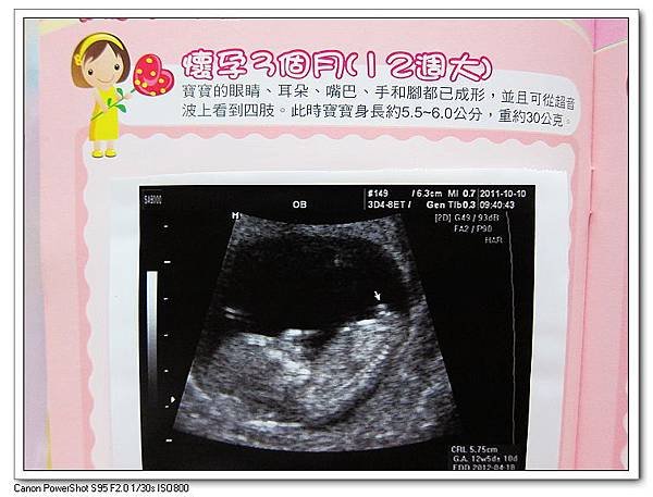 箭頭處醫生說猜是dd.JPG