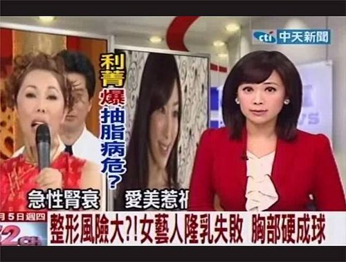 自體脂肪失敗