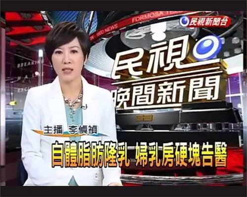 自體脂肪失敗5