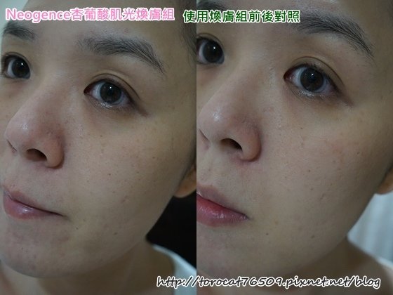 Neogence杏葡酸肌光膚組-使用七天前後照1.jpg