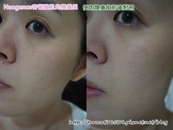 Neogence杏葡酸肌光膚組-使用七天前後照3.jpg