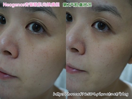 Neogence杏葡酸肌光膚組-第2天肌膚狀況.jpg