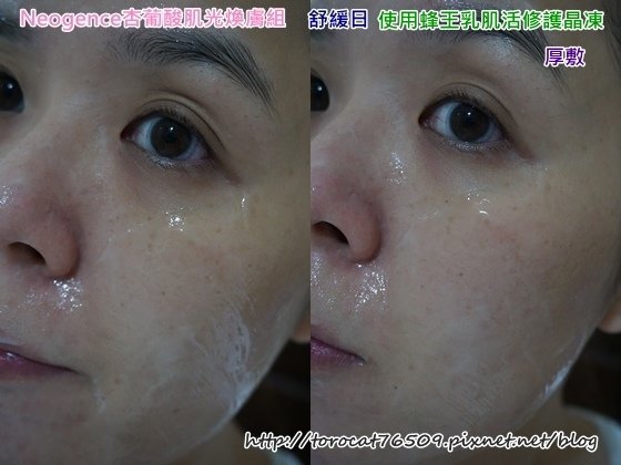 Neogence杏葡酸肌光膚組-舒緩日(使用晶凍中.jpg