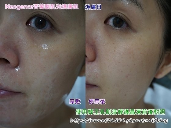 Neogence杏葡酸肌光膚組-煥膚日(使用晶凍前後).jpg