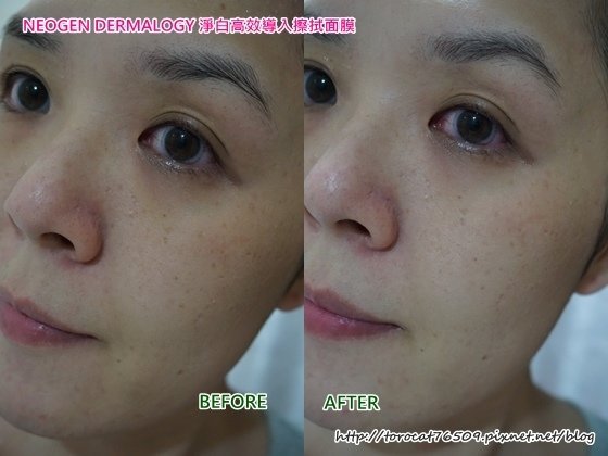 NEOGEN DERMALOGY 淨白高效導入擦拭面膜-使用前後.jpg