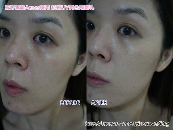 曼秀雷敦Acnes藥用 抗痘UV潤色隔離乳-使用前後2.jpg