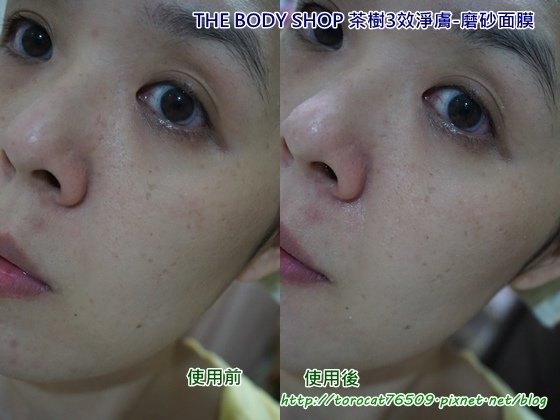 THE BODY SHOP 茶樹3效淨膚-磨砂面膜-使用前後.jpg