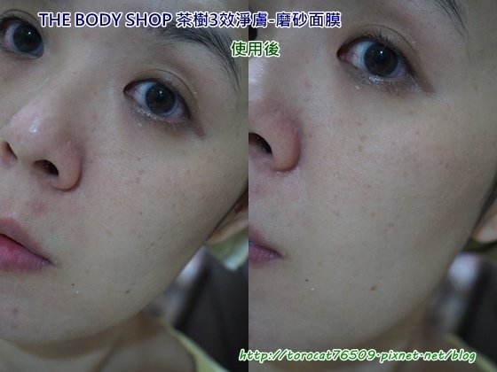 THE BODY SHOP 茶樹3效淨膚-磨砂面膜-使用後.jpg