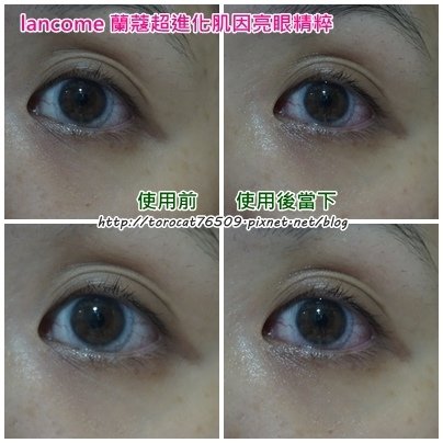 lancome 蘭蔻超進化肌因亮眼精粹-使用前後.jpg