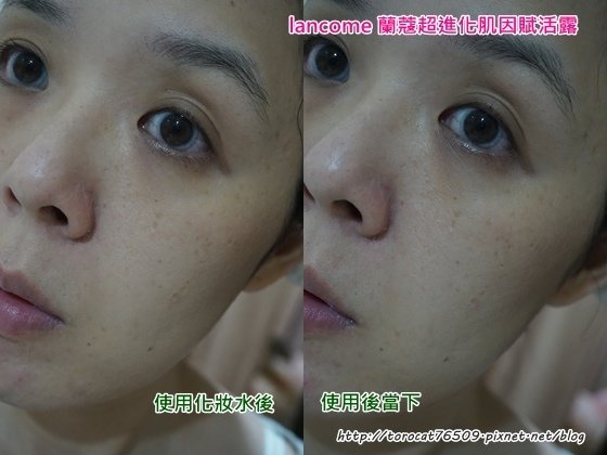 lancome 蘭蔻超進化肌因賦活露-使用前後1.jpg