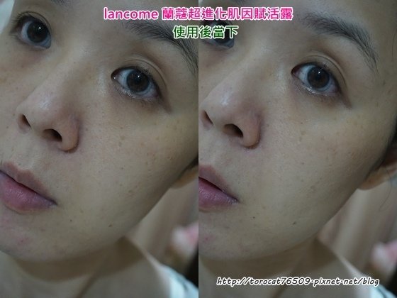 lancome 蘭蔻超進化肌因賦活露-使用後.jpg