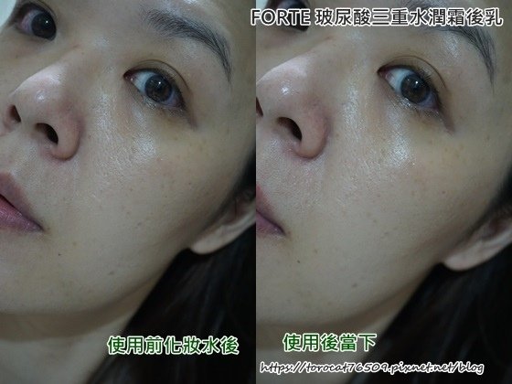 FORTE 玻尿酸三重水潤霜後乳-使用前後1.jpg
