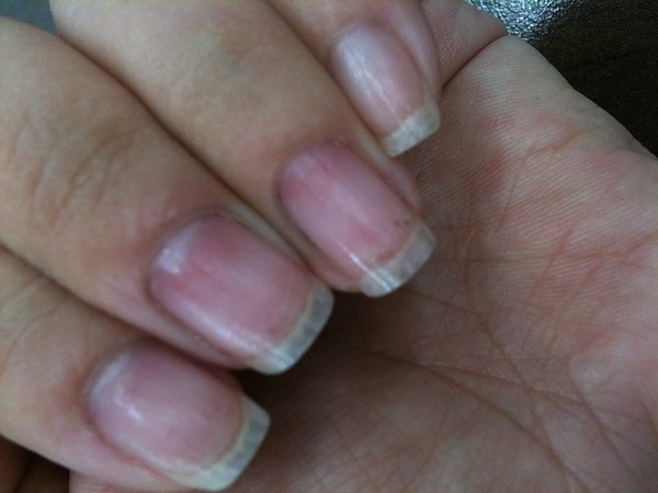 my nails