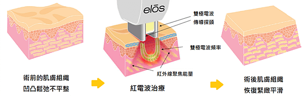 8-1.紅電波3-e1580885574657.png