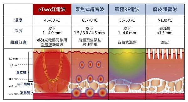 8-1.紅電波5-1030x559.jpg