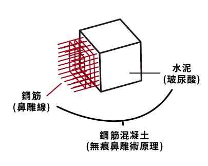 無痕鼻調術原理-01.jpg