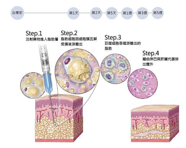 1.皮下燃脂5-1030x816.jpg