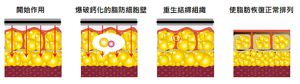 6.負壓塑脂儀9.png