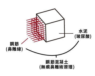 無痕鼻調術原理-01.jpg