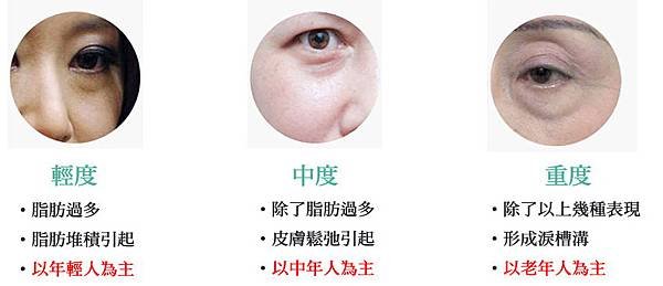 Trillia Peptide_眼袋舒緩_4.jpg