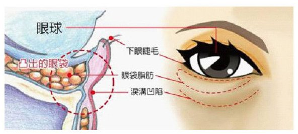 Trillia Peptide_眼袋舒緩_8.jpg