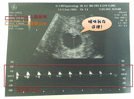 20140113 產檢week6