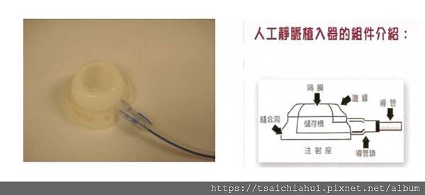 人工血管_01.jpg