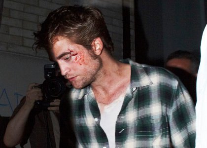 robert-pattinson-bloody.jpg