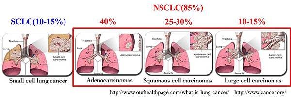 肺癌(2)-1.jpg