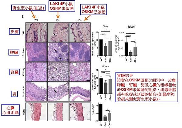 OSKM改善組織器官的老化情形.jpg
