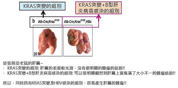 肝癌-腫瘤大小.jpg