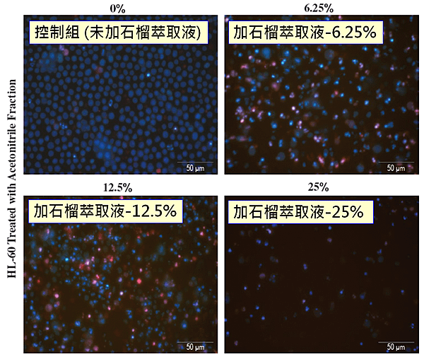 石榴-細胞凋亡觀察.png