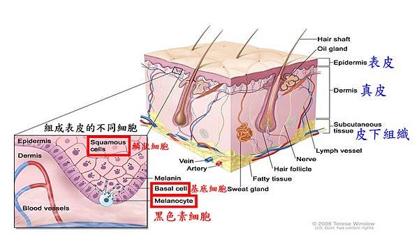 Melanoma-1-2.tif