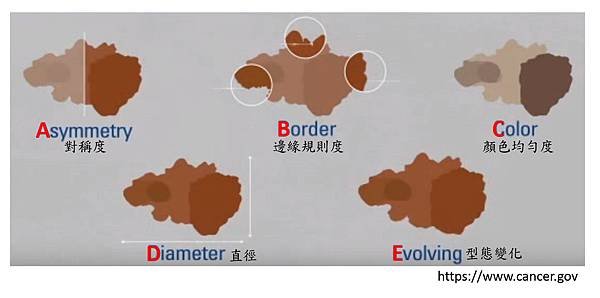 Melanoma-1-5.tif