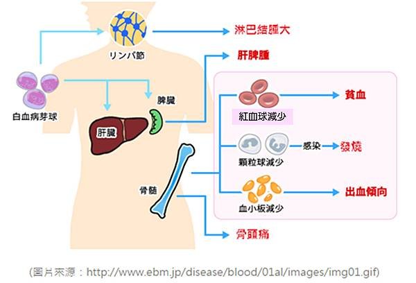 白血病症狀.tif