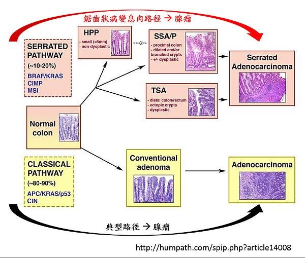 息肉分類-3.tif