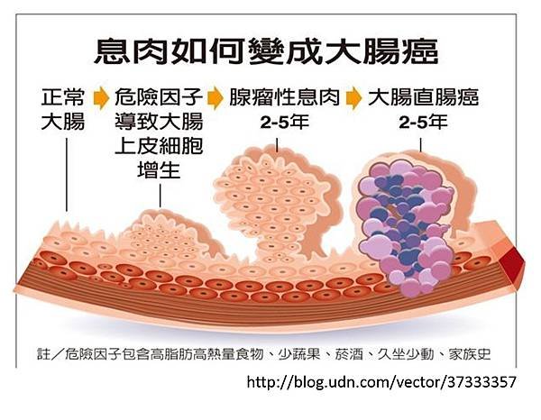 息肉形成原因-1.tif