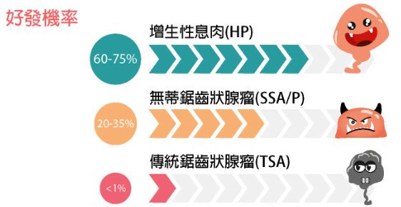 息肉症狀與瓶頸-3.tif