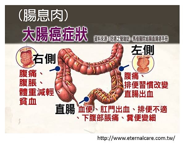 息肉症狀與瓶頸-1.tif