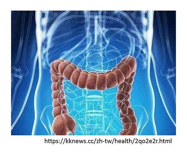 腸癌風險及預防-0.tif