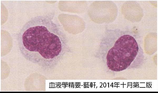 CLL-HCL.tif