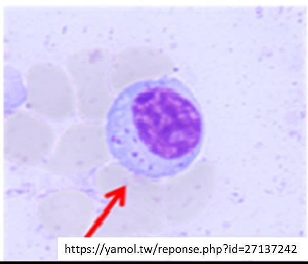 CLL-LGL.tif