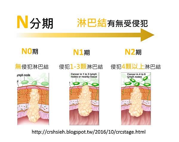 腸癌分期診斷-2.tif