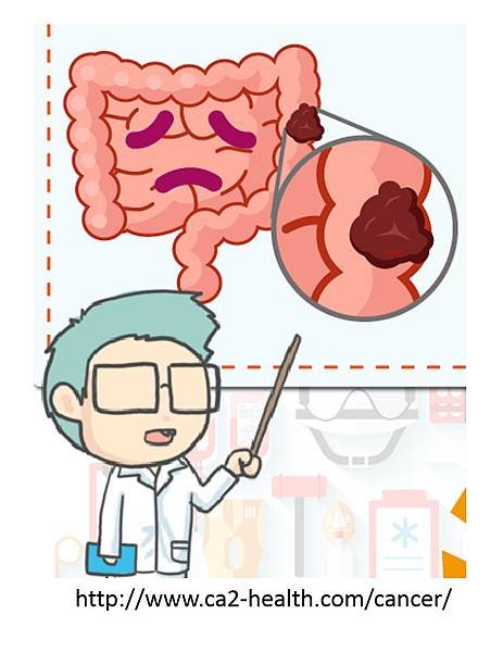 腸癌分期診斷-0.tif