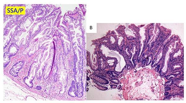 colon-SSA-P.tif