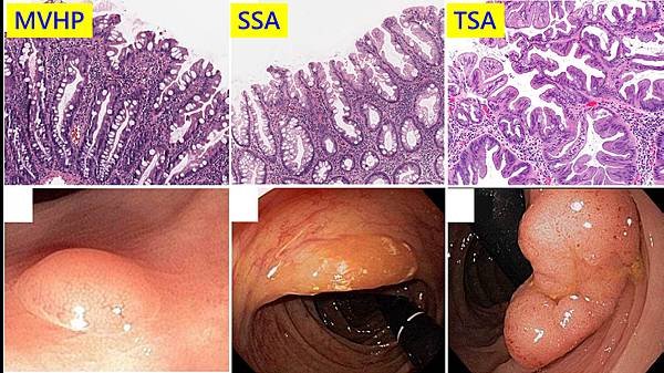 colon-endoscopy.tif