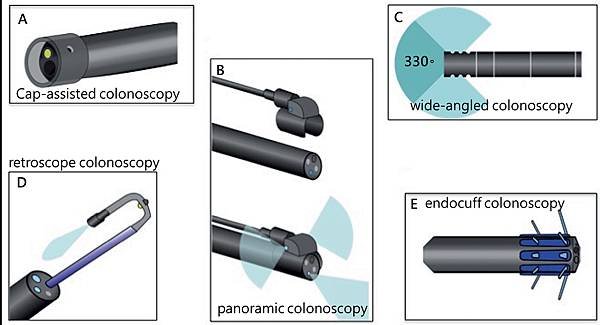 colon-different endoscopy.tif